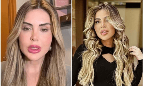 Às vésperas de se casar, jornalista contrai bactéria após troca de silicone