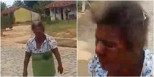 Jovem é presa suspeita de queimar o rosto da própria mãe com água quente na Bahia