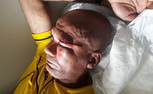 Árbitro de Futebol é agredido por atleta em partida do Campeonato da Cidade em Ipiaú