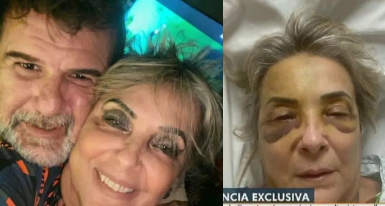 Desembargadora denuncia advogado com quem se relacionava por agressão