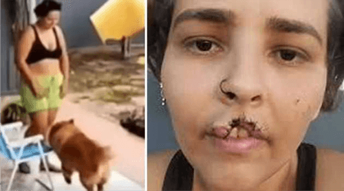 Chow-Chow ataca tutora: mordida grave arranca parte do lábio de Nati Olegario