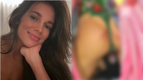 Ex-BBB Alane tranquiliza fãs após machucado assustador no bumbum em desfile da Grande Rio