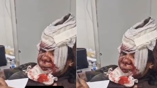 Mulher agredida com mais de 60 socos 'perdeu' a fala e escreveu depoimento para polícia