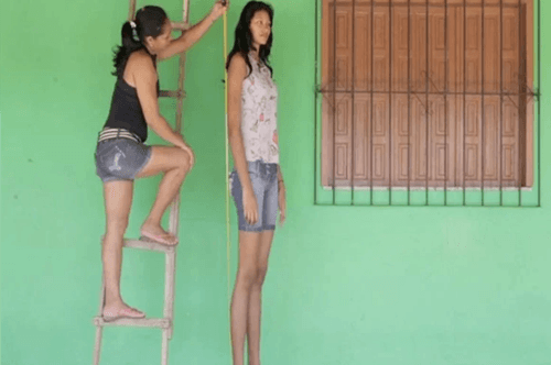 No Pará, mulher mais alta do Brasil enfrenta desafio de saúde