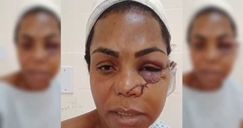 Mulher é atacada com facão pelo ex-companheiro