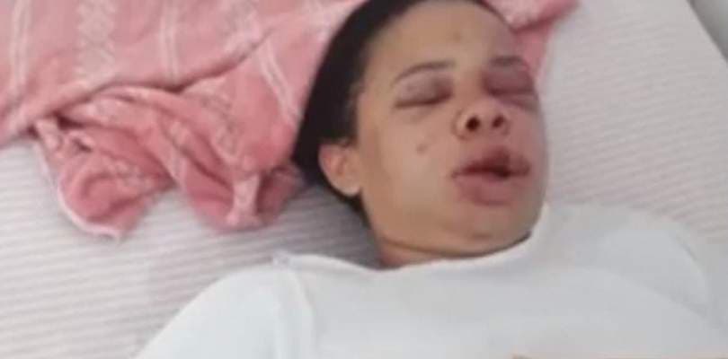 Com medida protetiva, jovem de 22 anos é espancada por ex-companheiro na Bahia