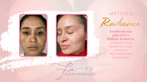 Ibirataia: Pele Impecável: Conheça o Método Radiance de Flávia Morgado
