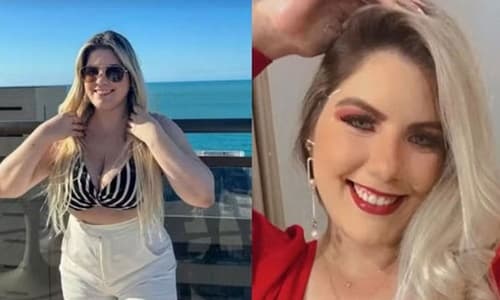 Empresária morre na véspera do aniversário após fazer seis cirurgias plásticas ao mesmo tempo