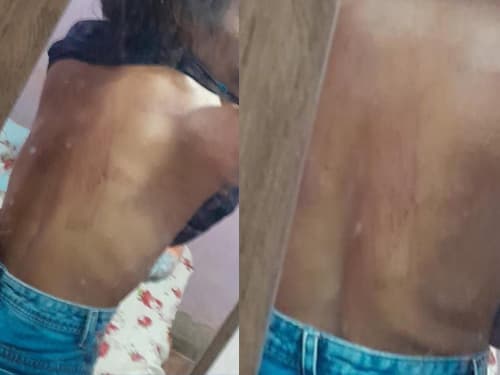 Jovem acusa namorado de agressões e ameaças na zona rural de Ibirataia