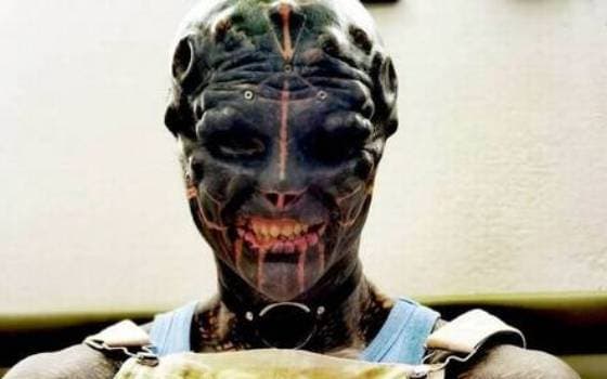 Homem amputa dedos para ficar mais parecido com 'alien'; veja