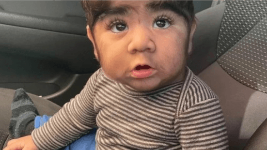 Bebê de 10 meses com barba viraliza nas redes sociais