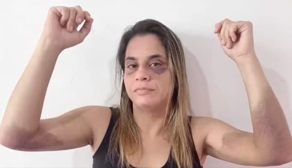 Empresária denuncia ex por agressões que duraram quase 2 anos