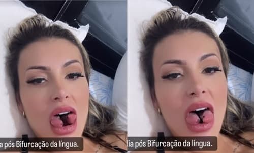 Andressa Urach realiza procedimento de ‘Língua de Cobra’ para potencializar conteúdos adultos