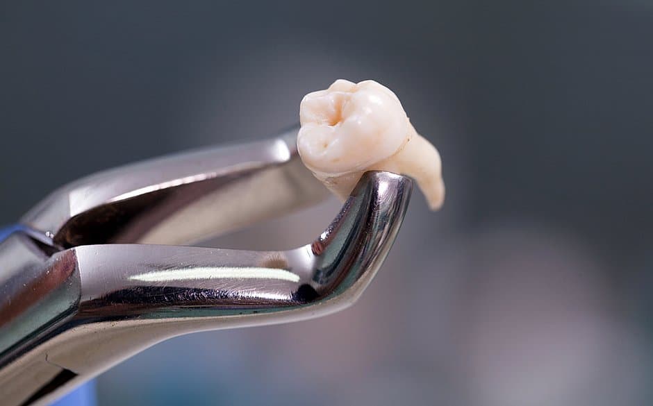 Morte de mulher após extração de dente na Bahia acende alerta