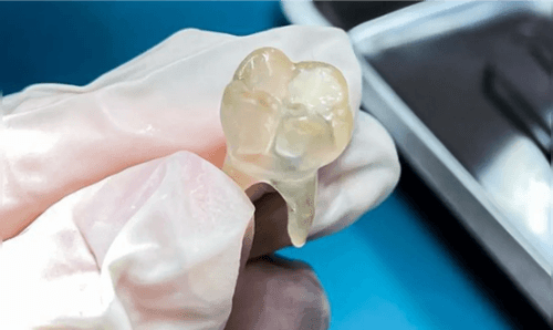 Impressão 3D na odontologia: baianos inovam modo ensino na Bahia