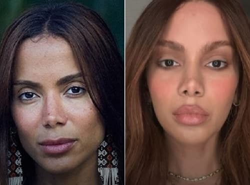 Anitta reaparece nas redes com rosto rejuvenescido após mais de um mês sumida