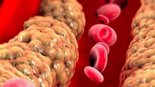 Consumo excessivo de frutose pode aumentar inflamação e risco cardíaco, alerta estudo