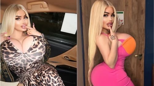 Influencer gasta R$ 2 milhões em plásticas para conquistar 'bumbum brasileiro' e enfrenta críticas