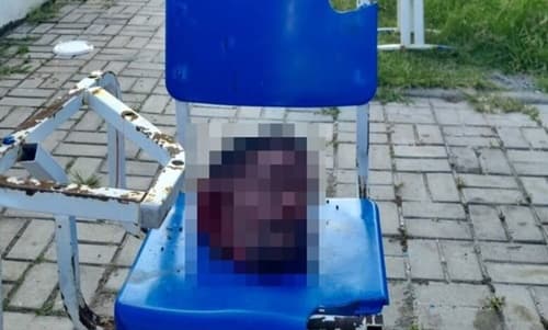 Cabeça é abandonada em posto de saúde na Bahia