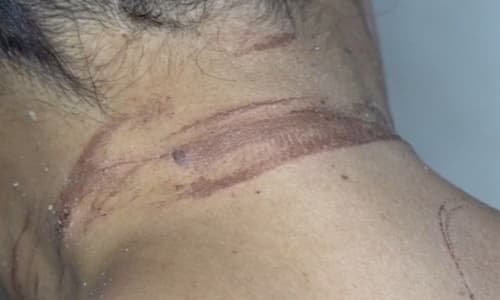 Mulher denuncia ter sido enterrada viva por ex-namorado em Itabuna