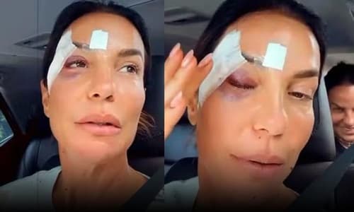 Ivete Sangalo recebe alta hospitalar após desmaio causado por desidratação em Salvador