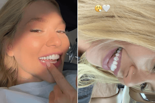 Virginia Fonseca surpreende seguidores ao aplicar diamantes no dente em formato de "V"