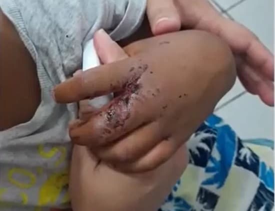 Almadina: Homem é preso por suspeita de maus-tratos contra filho de 4 anos