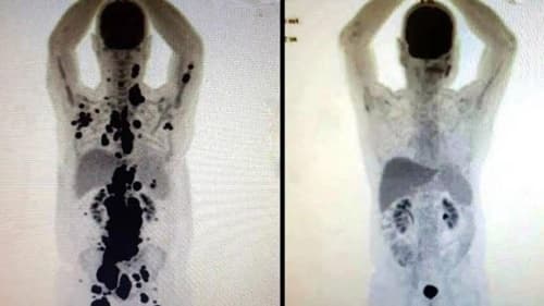 Pesquisadores Sul-Coreanos desenvolvem técnica inovadora para reverter células cancerígenas sem destruí-las