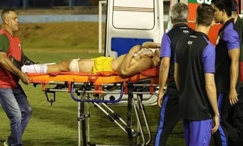 Imagem forte: policial atira em goleiro do Grêmio durante jogo