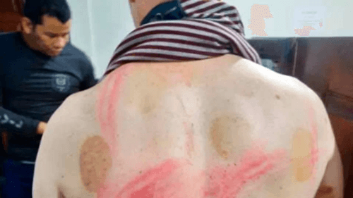 Professor da Unifap é espancado por policiais após gritar ‘Viva Lula’