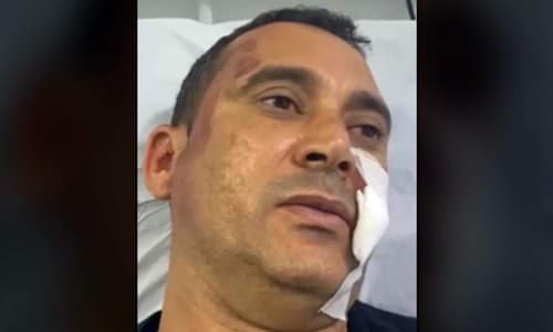 Vereador é agredido com socos e leva tiro de raspão na Bahia