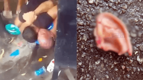 Homem arranca orelha de rival em briga