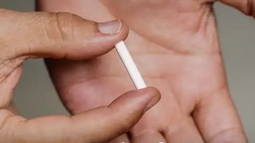 Planos de saúde passam a oferecer implante contraceptivo Implanon