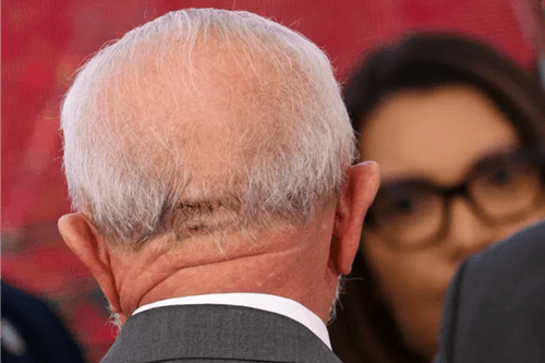 Lula aparece com pontos durante cerimônia no Palácio do Planalto