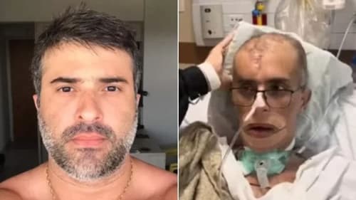 Policial civil baleado na testa durante operação morre após nove meses internado