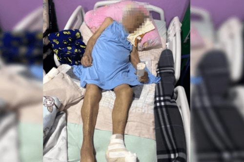 Enfermeira é investigada por amputar pé de idosa de 103 anos sem anestesia