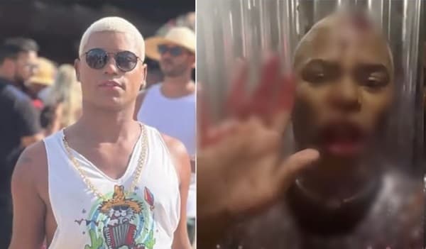 Influenciador é agredido com cacetada na cabeça por segurança em show do Parangolé
