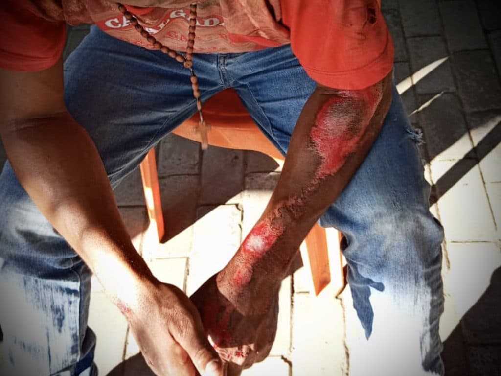 Ipiaú: Motociclista fica ferido em acidente no Passa com Jeito
