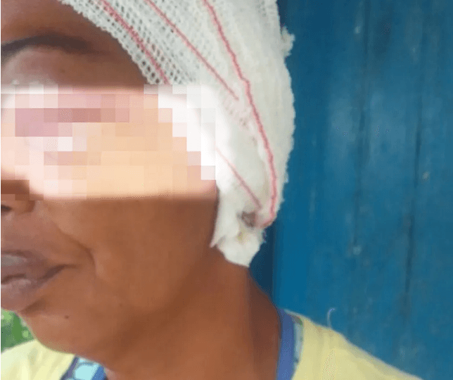 Mulher é agredida e tem orelha arrancada por filho e nora na Bahia