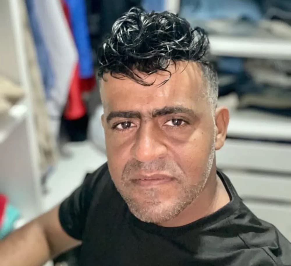 Intoxicação por anestésico causou morte de homem durante implante capilar