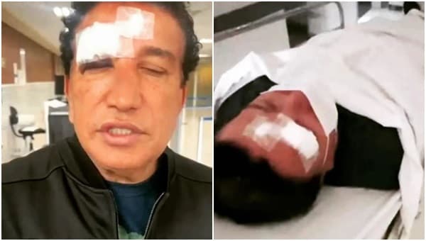Magno Malta sofre um acidente no hotel na cidade de Vitória da Conquista