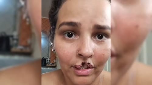 Chow-chow é sacrificado após ataque: marido manda matar cão que feriu esposa