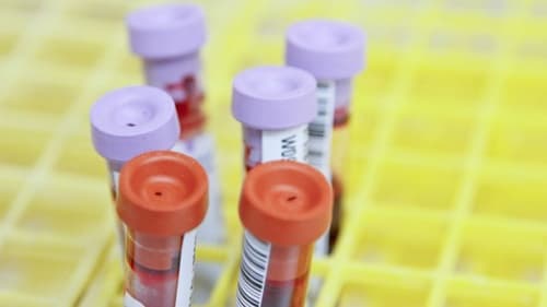 Caso raro: mulher engravida após relação com gêmeos e DNA não identifica o pai