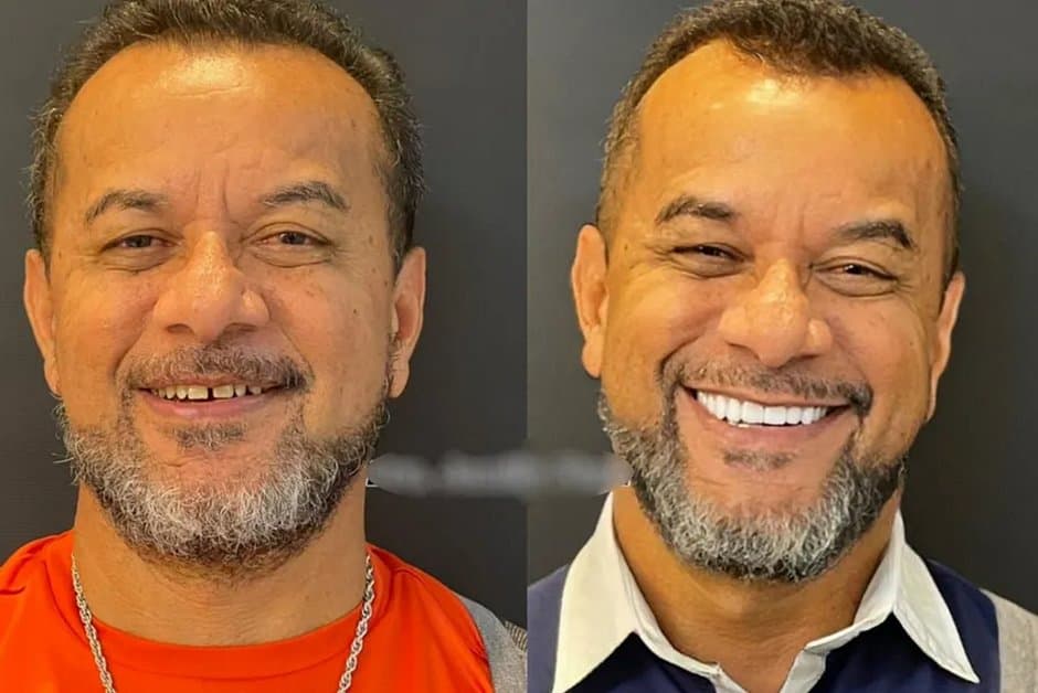 Funcionário público morre após colocar facetas dentárias, diz família