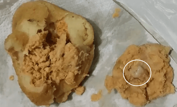 Mulher mastiga coxinha, sente algo diferente e acha dente humano no recheio