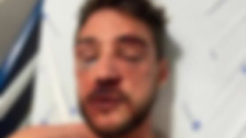 Brasileiros são espancados por seguranças de bar em Lisboa