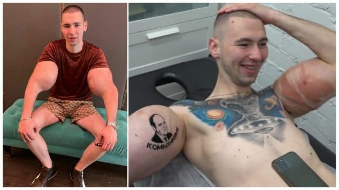 Bíceps de lutador de MMA ‘explode’ durante confronto