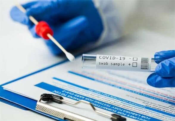 Municípios baianos vão receber 340 mil testes rápidos para detecção da Covid-19