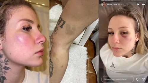 Ex-mulher de jogador do Palmeiras denuncia atleta por agressão e expõe fotos com hematomas