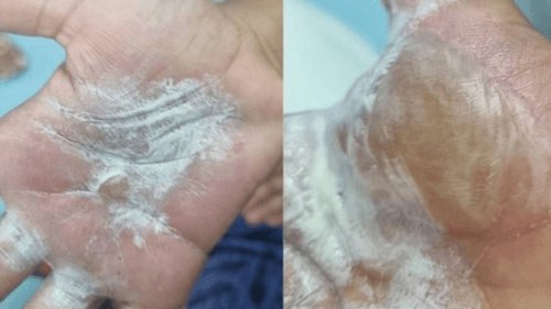 Mulher é presa suspeita de queimar e agredir filhos em São Francisco do Conde